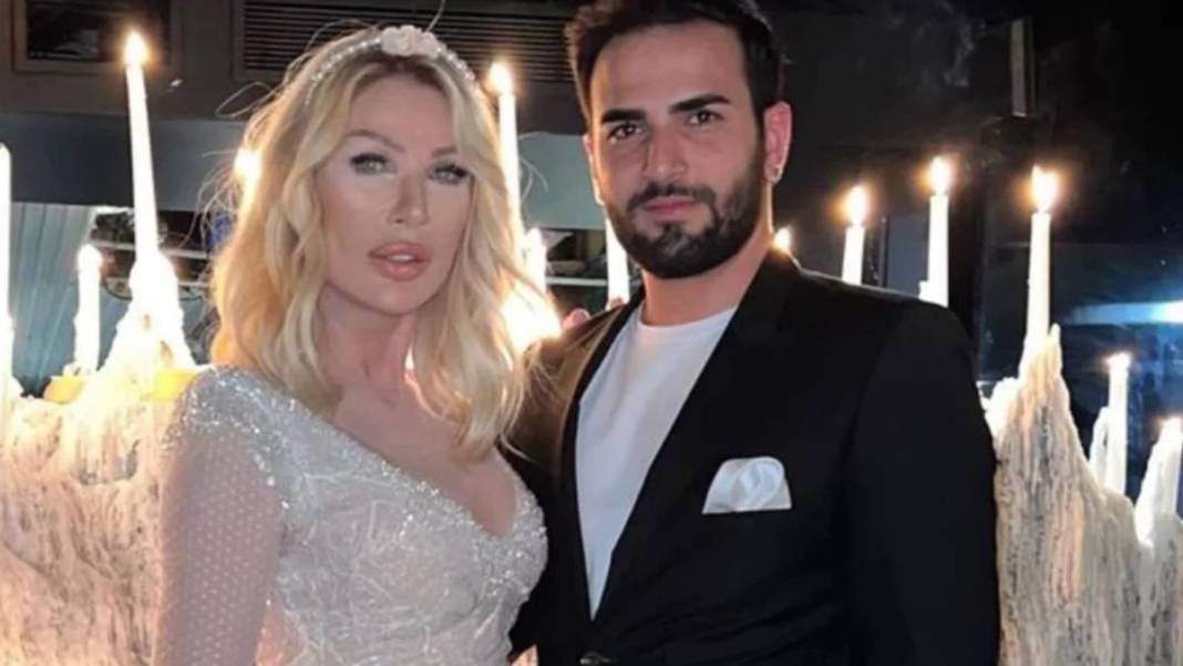 Estetik de çözüm olmadı! Seda Sayan çareyi bakın nede buldu: Abla burnun yok olmuş 2
